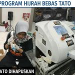 Berani Hijrah Tanpa Syarat Rumit: Hapus Tato Gratis di Masjid Sadji Malang Sentuh Perubahan Fisik hingga Spiritual