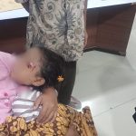 Anak 4 Tahun Diserang Anjing Liar di Bengkulu Utara Dua Anak Jadi Korban