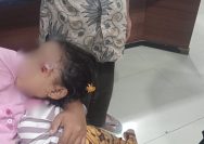 Anak 4 Tahun Diserang Anjing Liar di Bengkulu Utara Dua Anak Jadi Korban