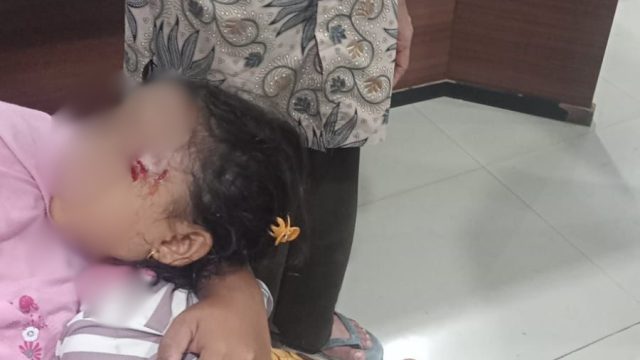 Anak 4 Tahun Diserang Anjing Liar di Bengkulu Utara Dua Anak Jadi Korban